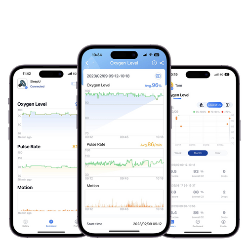 SleepU™ Wrist Sleep Oxygen Monitor